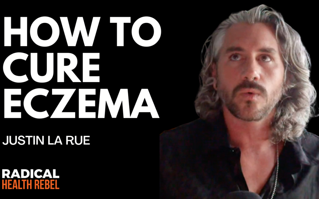 How to Cure Eczema with Justin La Rue