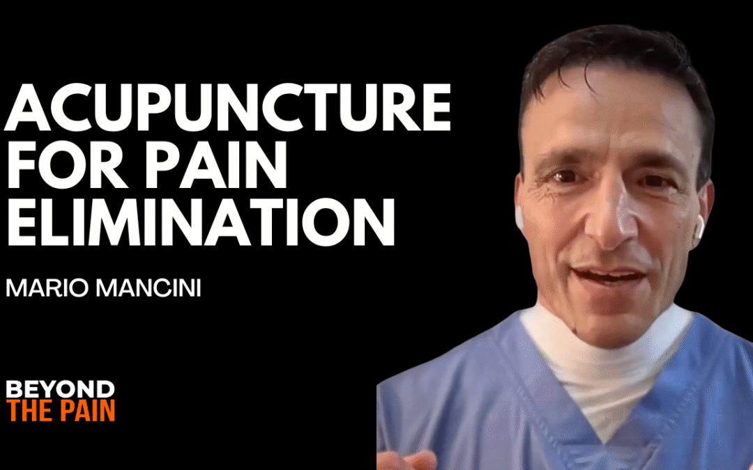Acupuncture for Pain Elimination: The Science Behind Rapid Healing Explained